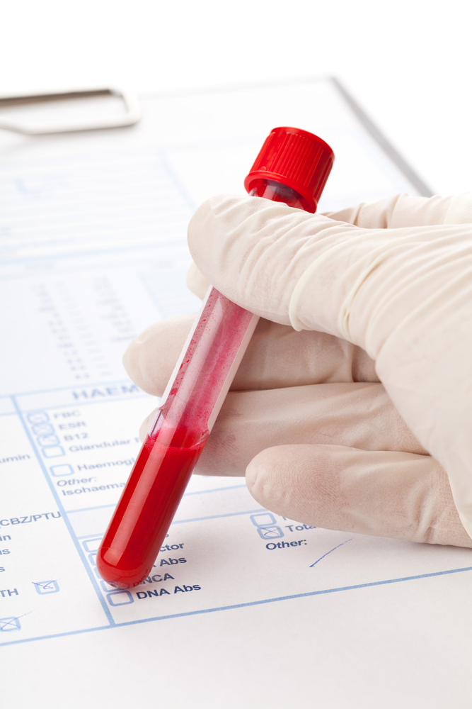 A picture of a hand holding a vile with a red substance over a medical form. 
